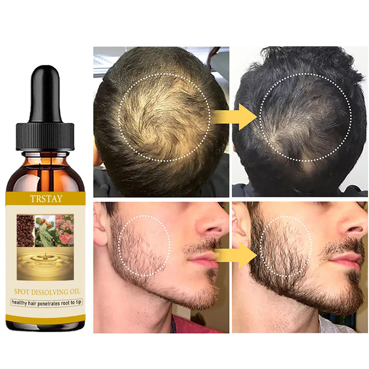 50ML huile de croissance de ba - Beard Oil Growth avis et prix