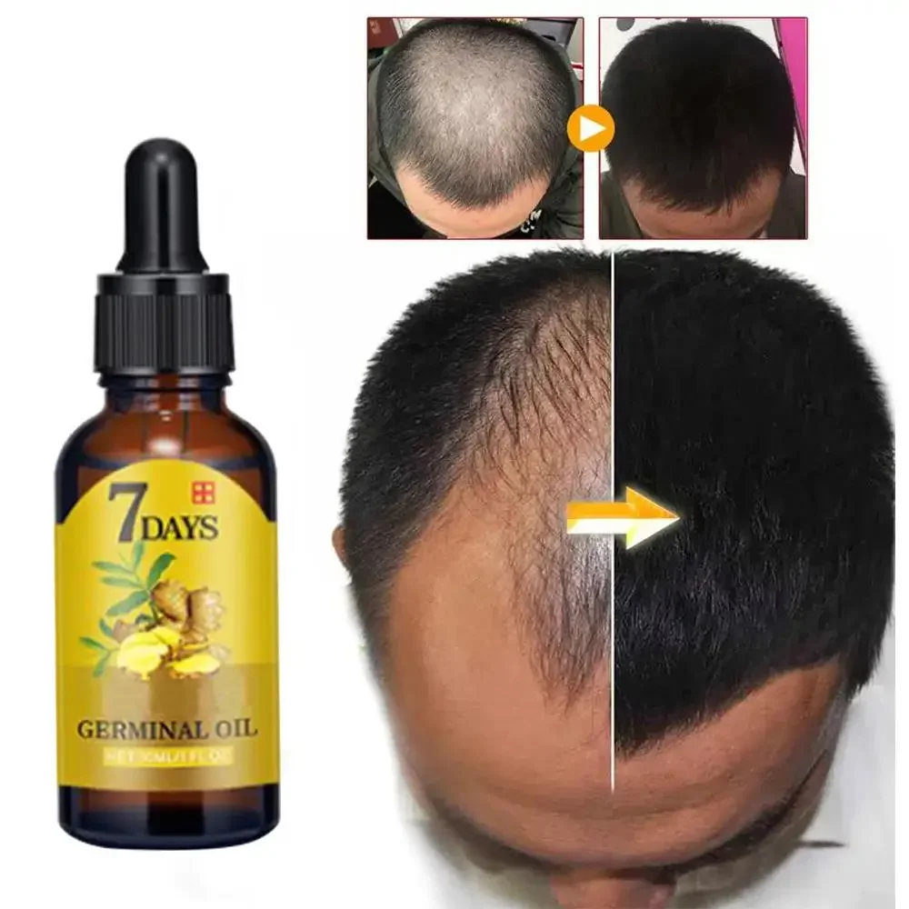 Huile essentielle de gingembre - Beard Oil Growth avis et prix
